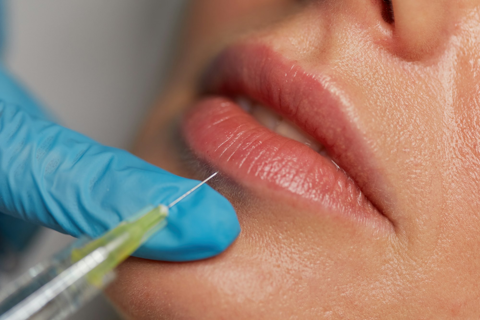 Closeup syringe with needle over female lips