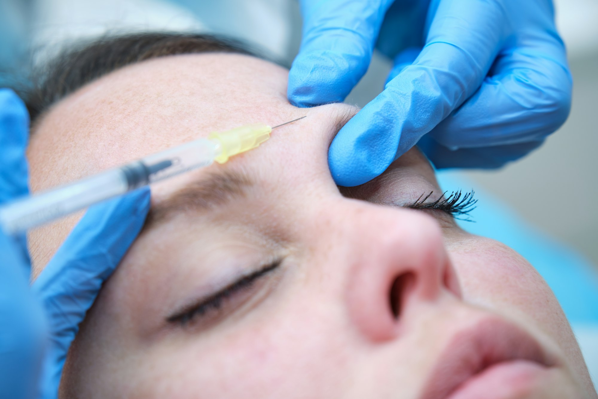 injecting botulinum toxin into corrugator brow